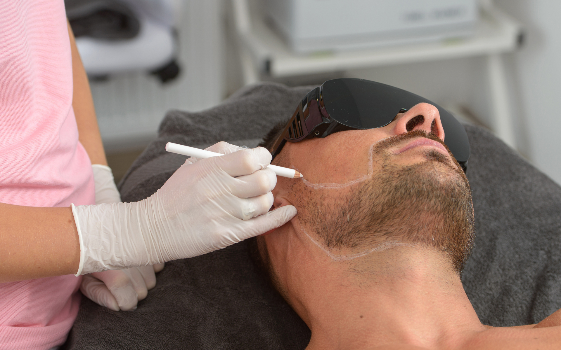 Mens Laser Hair Removal What You Need To Know 9315